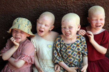 albinos_tanzania_15